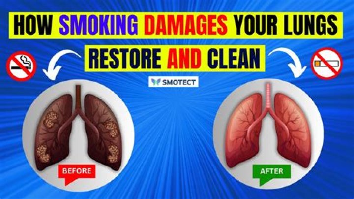 Can you recover your progress after hitting Fresh Start by accident?