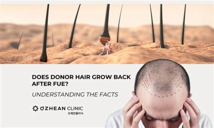 Does hair grow back?