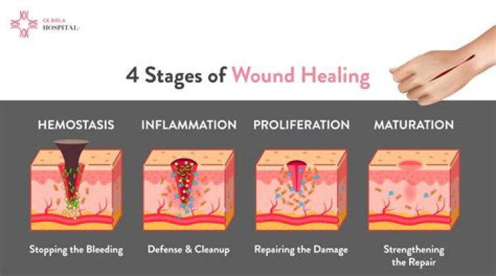 How can I heal Talion?