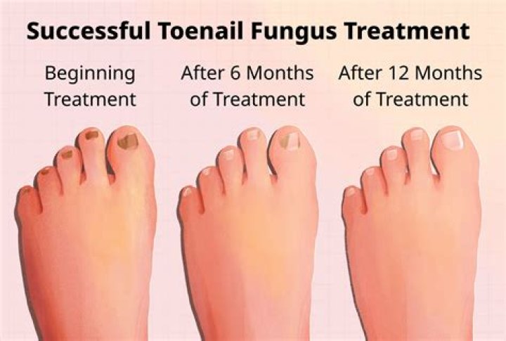How should I effectively use Fungal Growth?