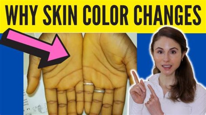 Why can't I change my skin?